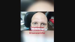 خدمات فیبروز ابرو | 