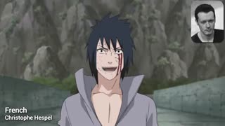 پنچ تا از صدا گزار های ساسکه ترمیم لبخند لثه‌ای