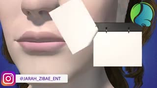 انیمیشن نحوه عملکرد ژل لب