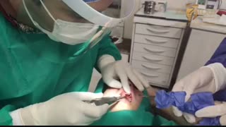 فیلم جراحی ایمپلنت دندان