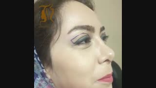 فیلم بدون سانسور جراحی پلک