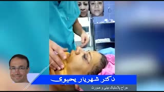 عمل جراحی زیبایی پلک و بینی | دکتر شهریار یحیوی
