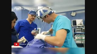 نتیجه جراحی بینی | بهترین جراح بینی تهران