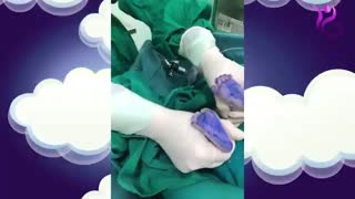 تولد شاهارا کوچولو به روش زایمان سزارین