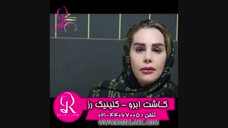 فیلم کاشت ابرو | کلینیک رز | 09104440228 | شماره 199