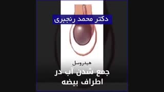 علت های درد بیضه چیست؟