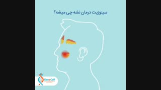 معضلات سینوزیت در صورت عدم درمان