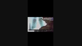 آشنایی با کرونا ویروس