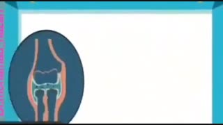 ارتروز زانو