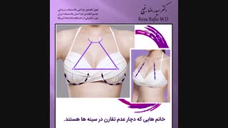 کاندیدای مناسب ماموپلاستی | دکتر رضا رفیع