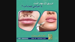 تزریق ژل بهتر است یا جراحی لیفت لب ماموپلاستی