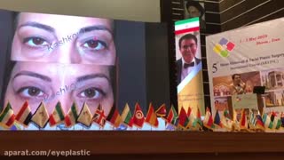 بلفاروپلاستی قبل از جراحی افتادگی پلک و افتادگی ابرو | پروفسور کشکولی