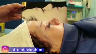 جراحی زیبایی بینی و پلک توسط دکتر امید ابراهیمی بهترین جراح زیبایی در تهران