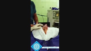 جراحی زیبایی بینی در مردان