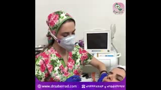 مزوتراپی صورت پر کردن دندان