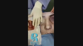 فیلم واقعی جراحی بینی