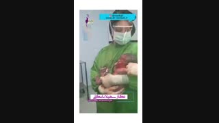 فیلم زایمان سزارین یه کوچولوی خوشگل و ناز