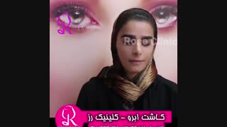 فیلم کاشت ابرو | کلینیک رز | 09104440228 | شماره 204
