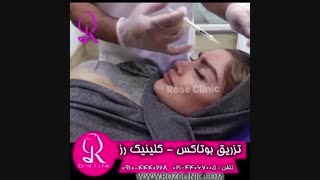 فیلم تزریق بوتاکس | کلینیک رز | 09104440228 | شماره 1
