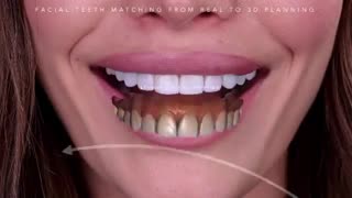 طراحی لبخند دیجیتال
