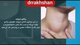 انیمیشن درباره تیروئید