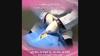 زاویه سازی صورت
