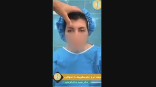 فیلم جراحی لیفت اندوسکوپیک ابرو با اندوتاین