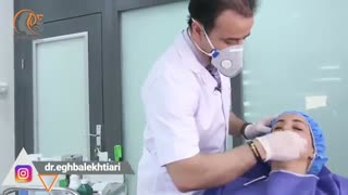 فیلم تزریق ژل گونه