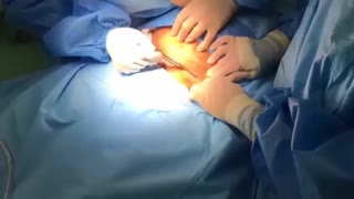 تولد نوزاد توسط دکتر هاشمی جم