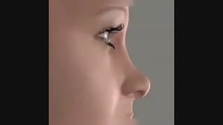 انیمیشن جراحی بینی ترمیمی