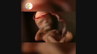 زایمان سزارین بدون سانسور