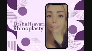 نمونه کار دکتر شهسواری جراح بینی زیبایی