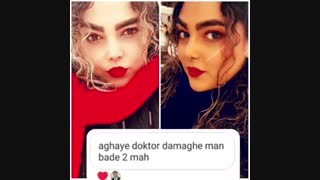 نمونه عمل دکتر شهسواری جراح بینی زیبایی