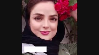 نمونه عمل دکتر شهسواری جراح بینی زیبایی کشیدن دندان