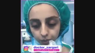 نمونه جراحی بینی دکتر زرگری