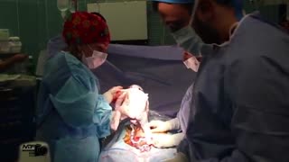 زایمان سزارین در تهران