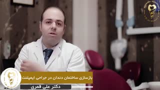 بازسازی ساختمان دندان در جراحی ایمپلنت