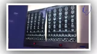 جراحی تومور لوب عمقی پاروتید