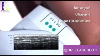 فیلم هایفوتراپی