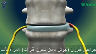 جراحی ستون فقرات