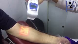 دستگاه رگ یاب