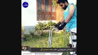 تعویض مفصل زانو، ۰۹۱۲۸۳۳۲۸۲۱
