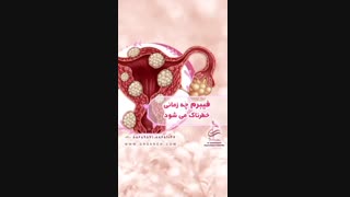 فیبروم رحم