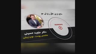 شایع ترین علل ریزش مو