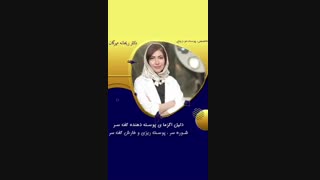 دلیل اگزمای پوست دهنده سر