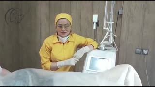 لیفتینگ و لابیاپلاستی