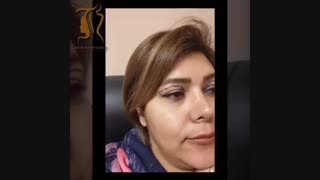 فیلم جراحی زیبایی پلک فوقانی