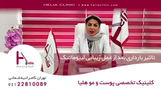 تاثیر بارداری بعد از عمل زیبایی لیپوماتیک | کلینیک هلیا | 02122810089