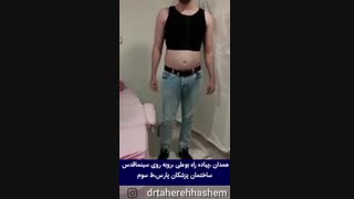 رضایت بیمار ژنیکوماستی