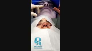 فیلم رضایت از جراحی بینی